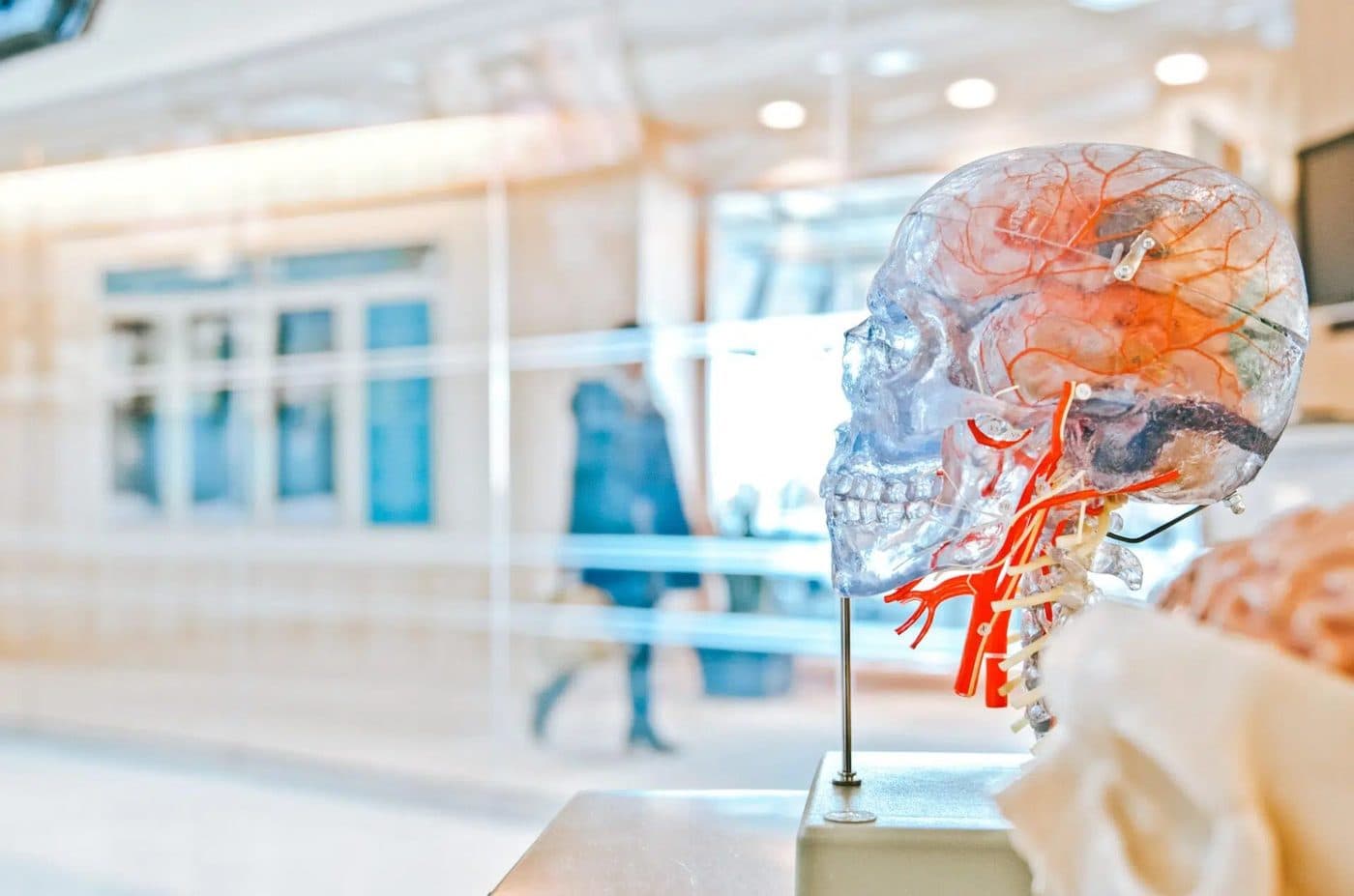 An anatomical brain model showing the cerebral blood vessels on a clinic desk