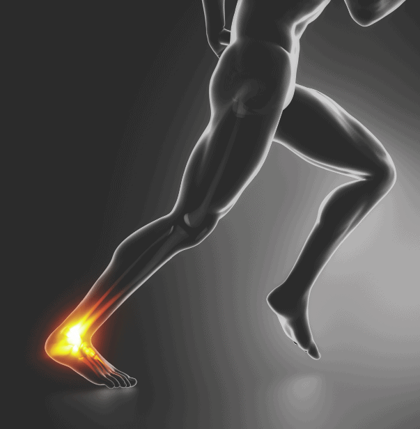 Ankle Sprain Treatment at Physio Logic Physical Therapy in Downtown Brooklyn