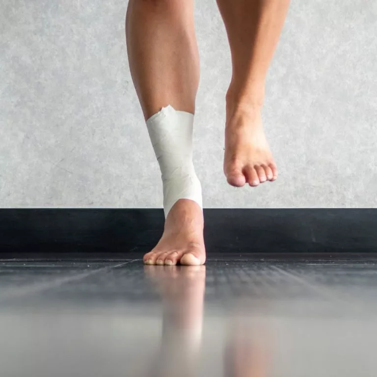 rolled ankle swollen