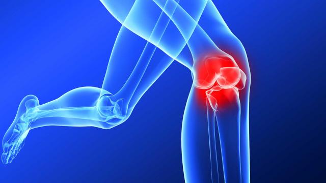 ACL Injury