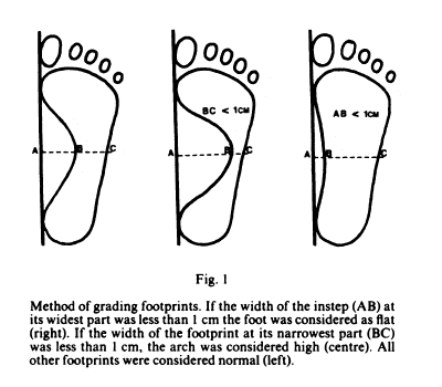 Weak Arches Diagram